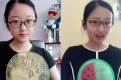 吃瓜爆料抖音网红男整容,颜值逆袭还是过度整形？